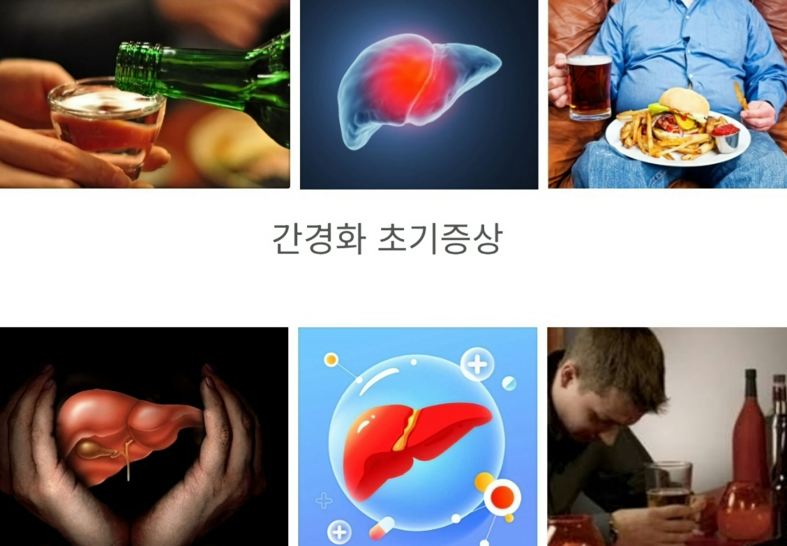 간에 안좋은 식습관