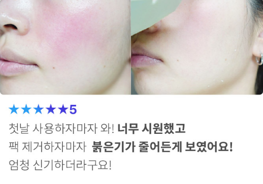 모델링팩 사용 전후 효과 피부 열감 내리는 법