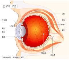 라식과 라섹 차이점