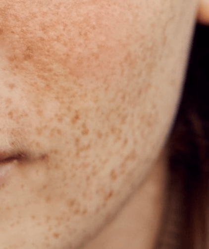 썬크림(자외선 차단제) 알아보기