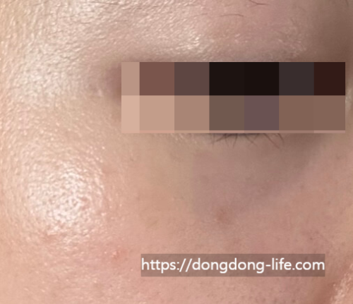 중계의원 기미 리뷰