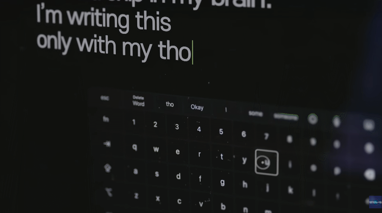 뇌에 임플란트 박고 몸 업그레이드 되고 있는 요즘 무서운 현실.jpg | 인스티즈