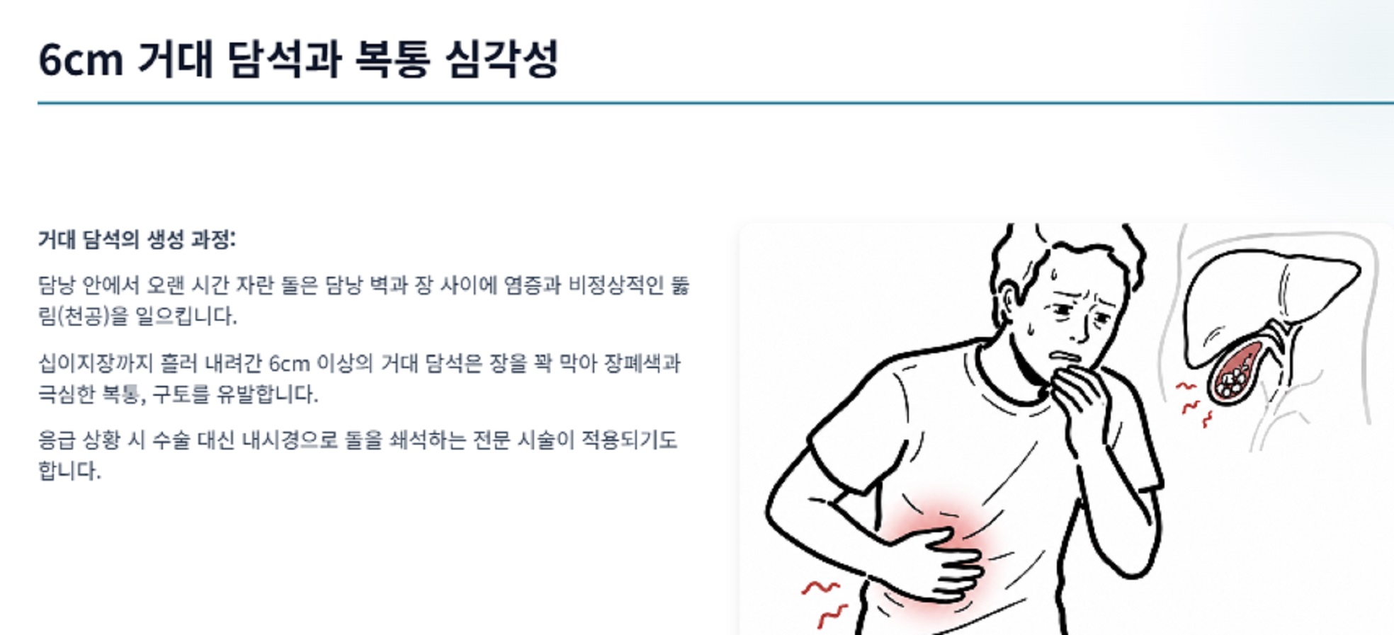거대담석-천영국-교수