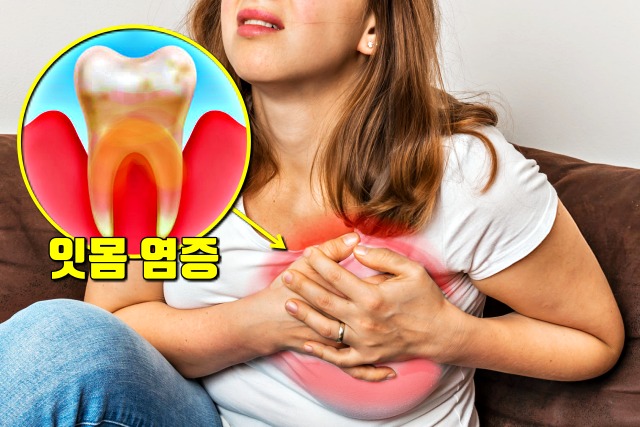 이가 시릴때,잇몸이 붓고 아플때,심근경색,뇌졸중,치주염,풍치,건강