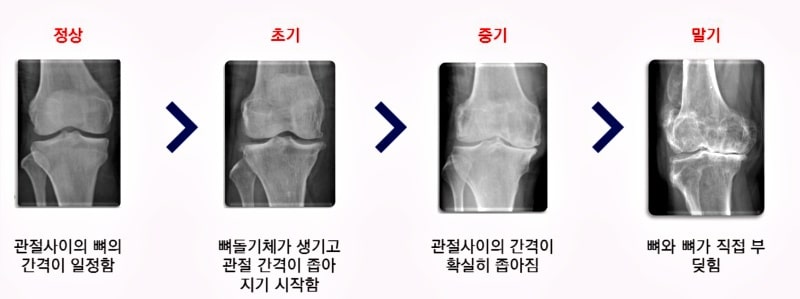 정확한-진단을-위한-검사-방법
