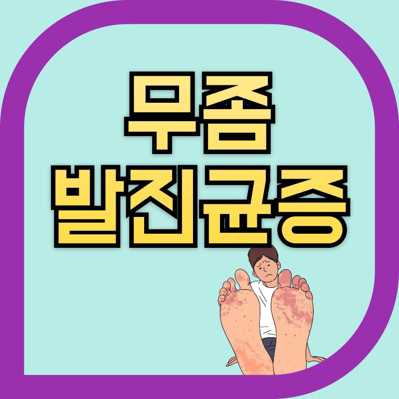 무좀균으로 발 바닦에 균이 퍼진 이미지