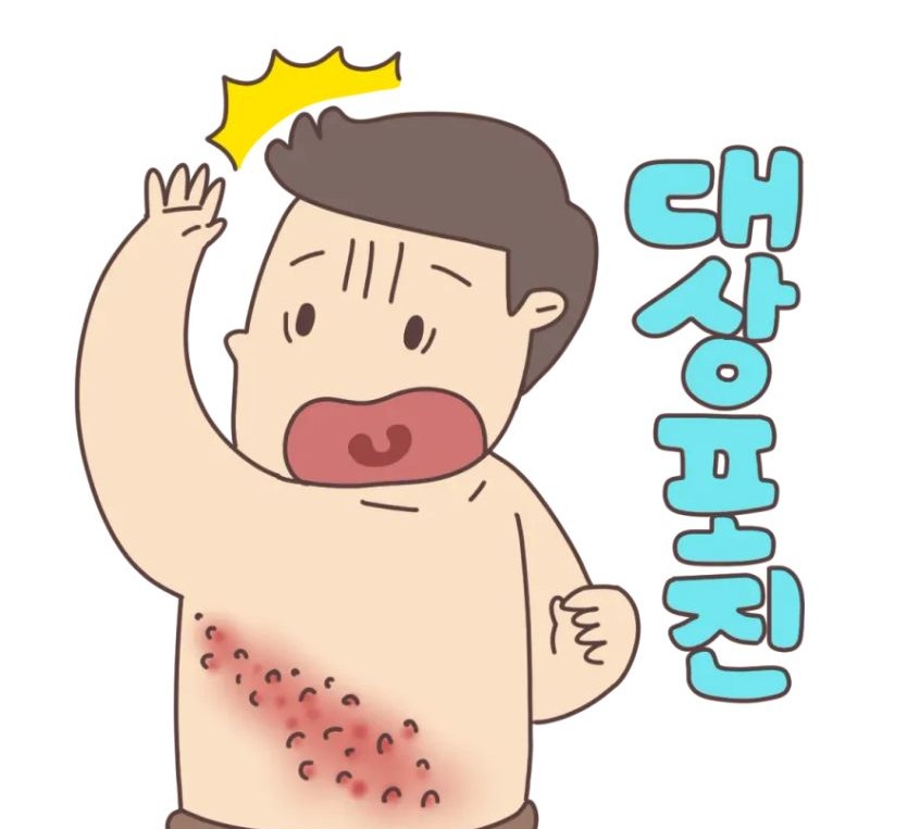 대상포진 이미지