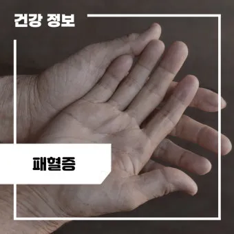 패혈증이란 무엇인지 원인 증상 치료 예방법_13