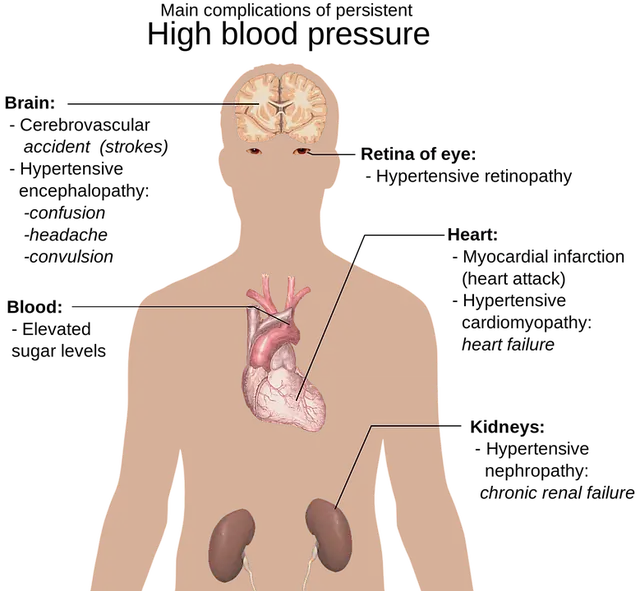 고혈압 낮추는 방법