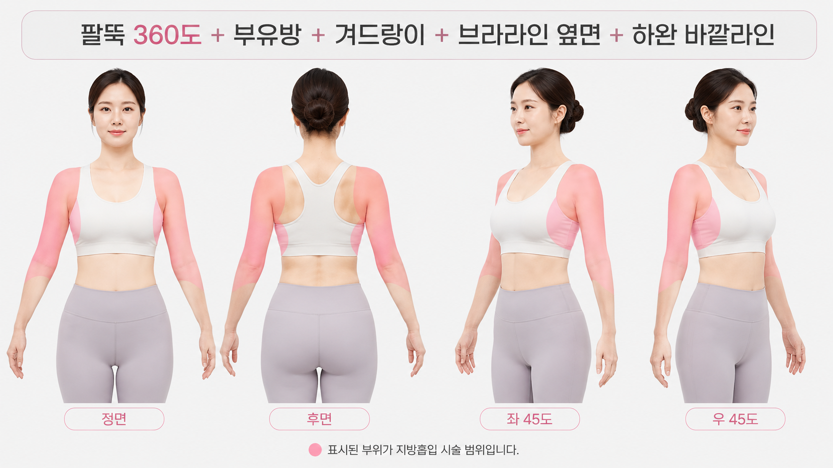 팔뚝360도와 부유방, 겨드랑이, 브라라인 일부의 지방을 함께 제거해야 합니다.
