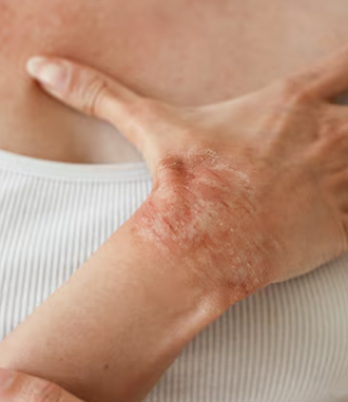 겨드랑이 통증 30