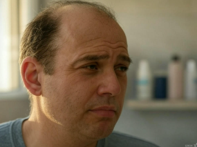 탈모약 종류 비교: 어떤 약이 나에게 맞을까?