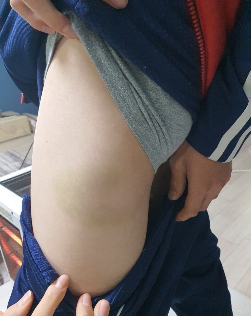 손웅정 아동학대