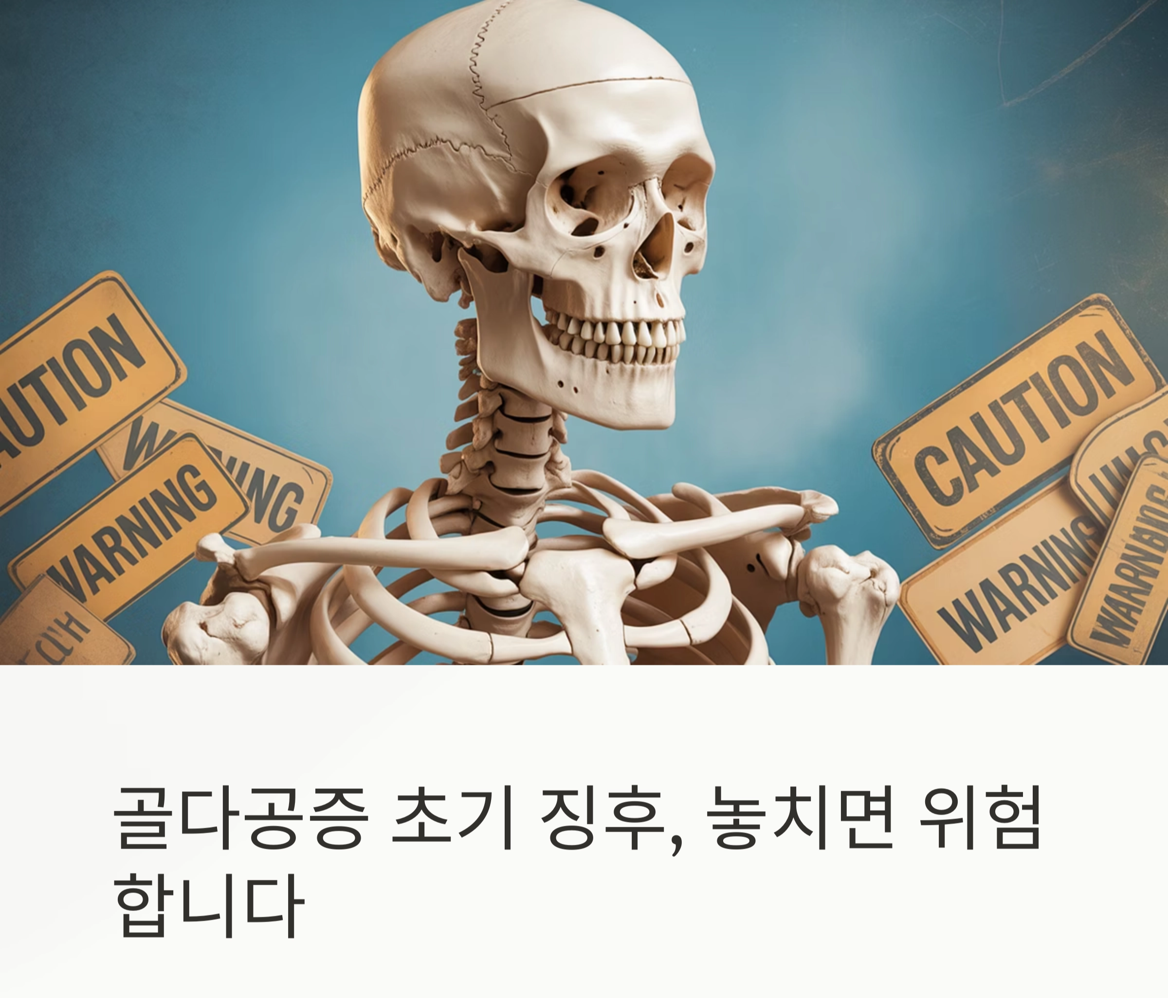 골다공증 초기 징후, 절대 무시하면 안 되는 이유