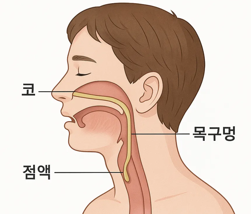 후비루 증후군 기본정보