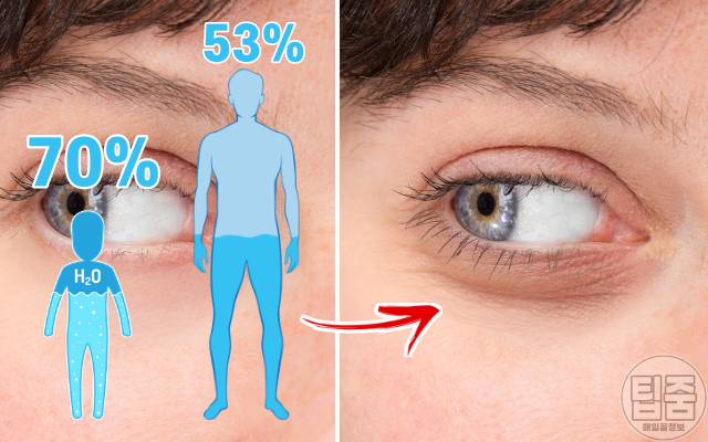 만성탈수 증상,만성탈수 질환,만성탈수 자가진단법,노화 주름살,팁줌
