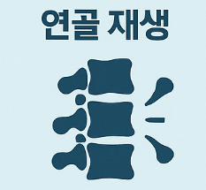 철갑상어 콘드로이친