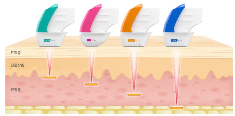 슈링크-리프팅-효과