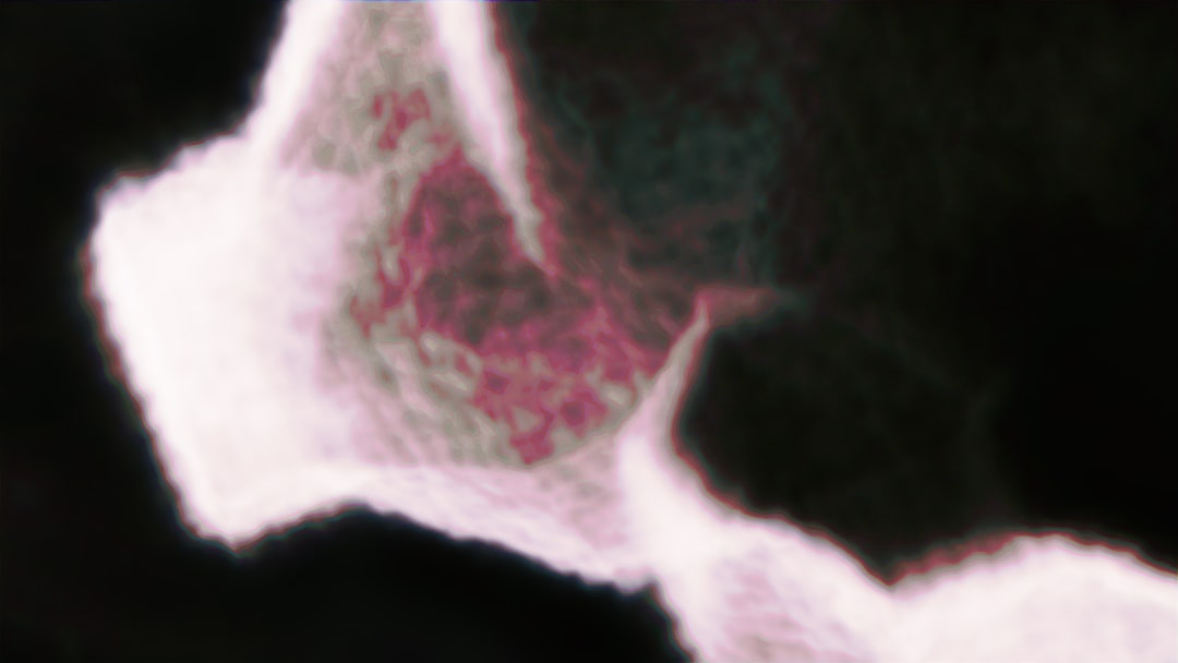 TMJ (temporomandibular joint)