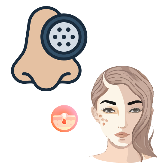 피지샘증식증의 감별진단