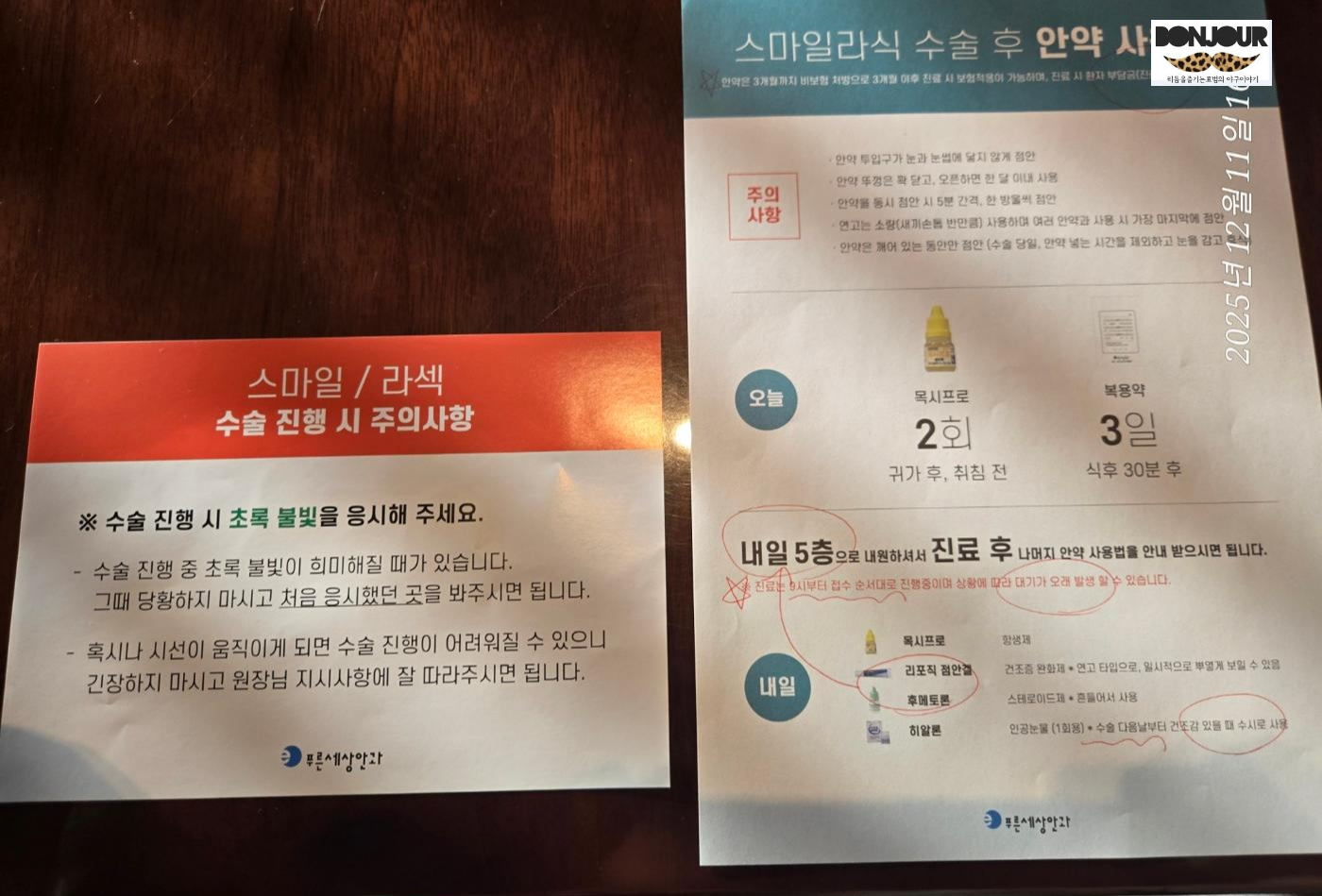 푸른세상안과 스마일라식주의사항