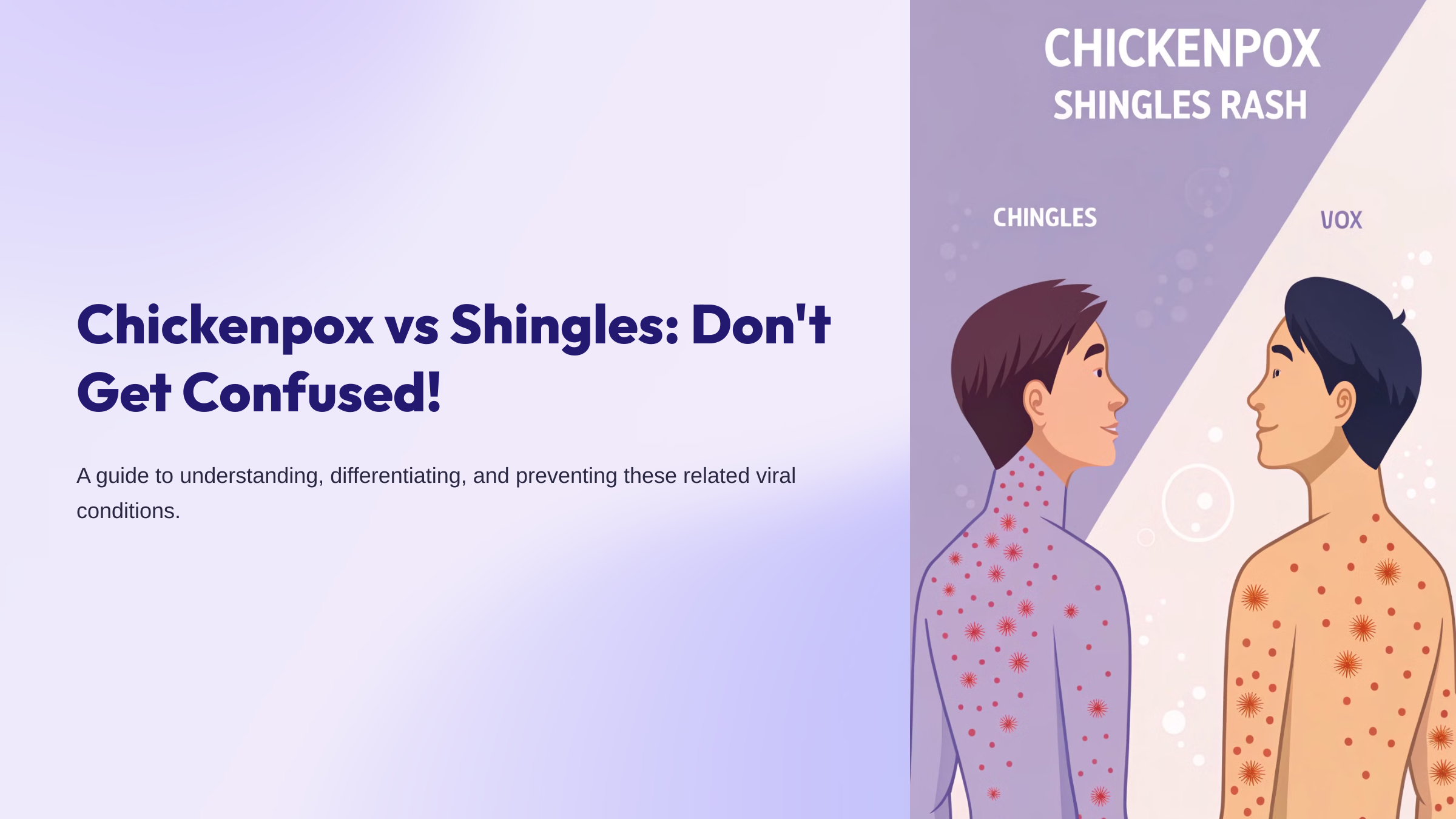 comparison of chickenpox and shingles rashes side by side, medical illustration, educational, clear detail of blisters, professional lighting