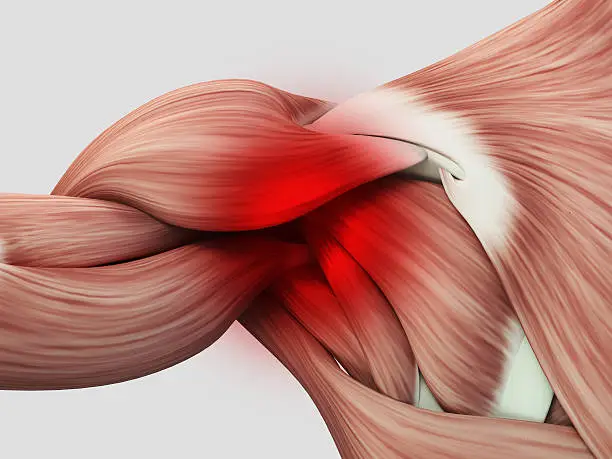 이두건염은 어깨 통증으로 많이 오는데요~ 어깨통증에 이두건염은 생소하실 수 있습니다. 어떤 증상으로 통증이 발생하는지와 치료방법에는 무슨 방법이 있는지, 재발을 예방할 수 있는지 확인해 보시기 바랍니다.