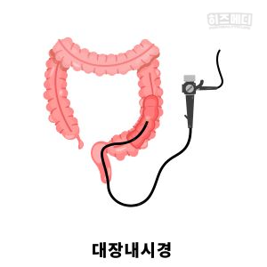과민성 대장 증후군 진단 치료