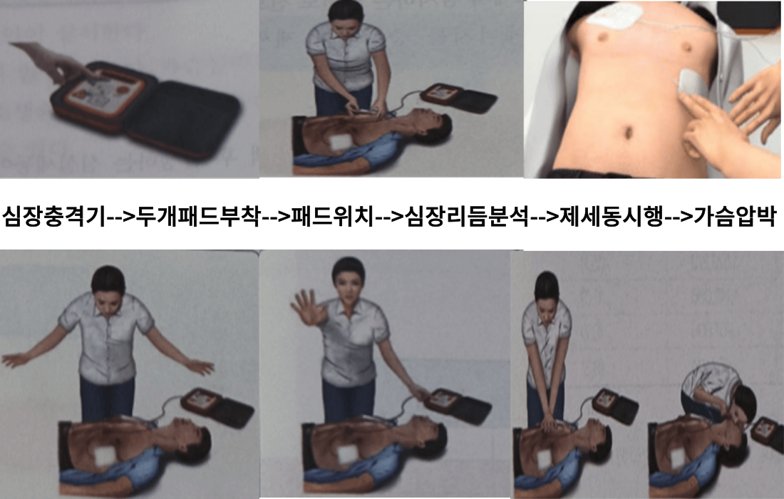 심장충격기 사용방법