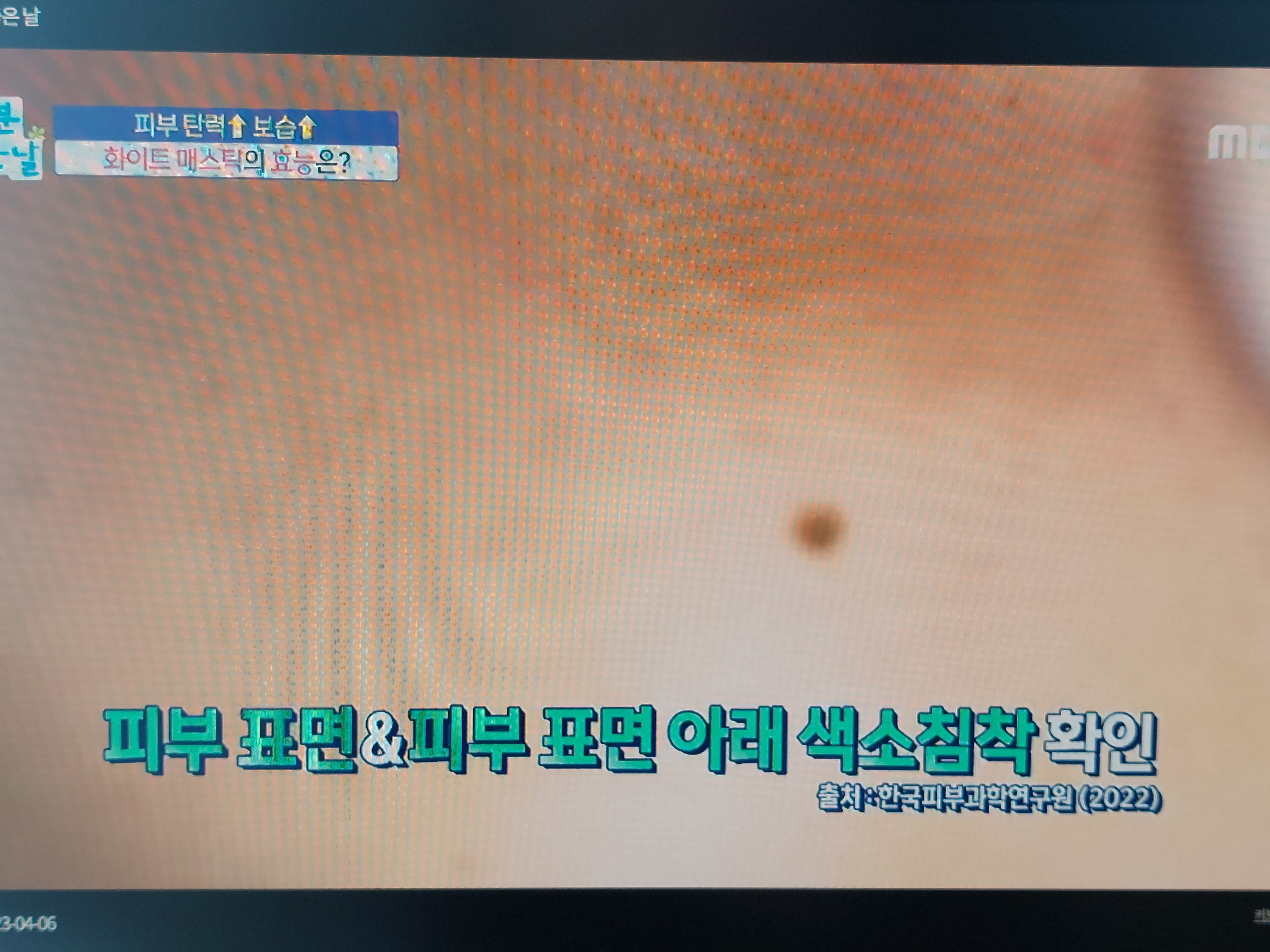 화이트 매스틱 효능