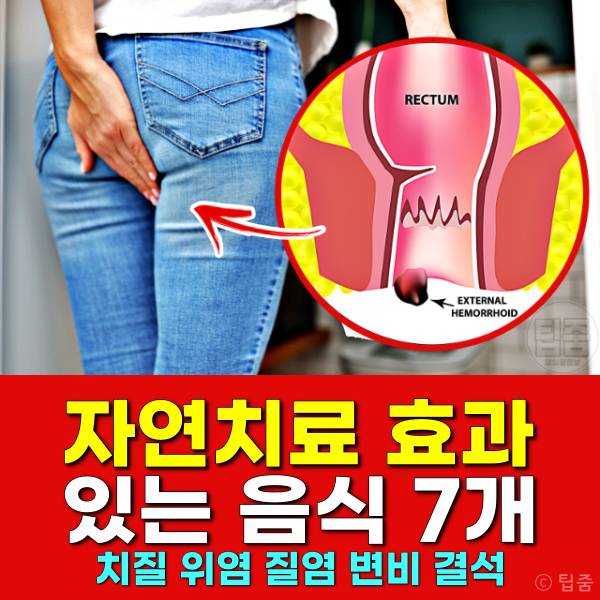 치질 자연치료 음식