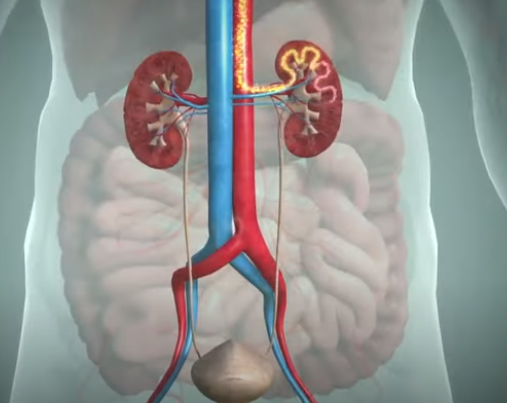 통풍 증상과 치료방법