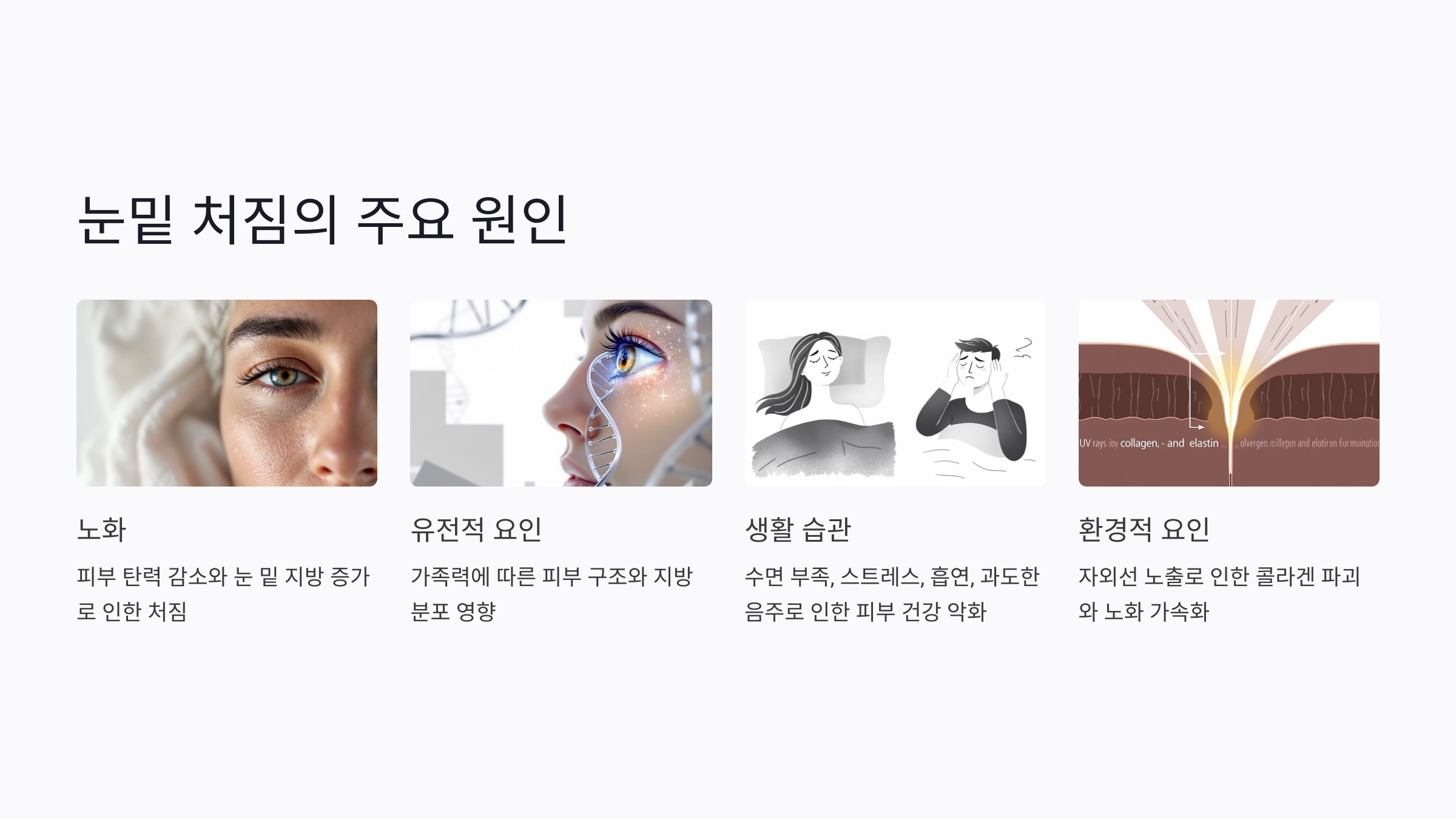 쳐진 눈