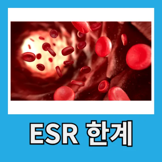 ESR 검사의 한계