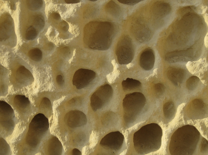 과민성 대장증후군 증상 17