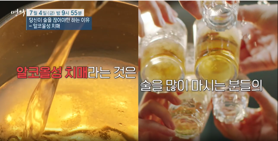 명의/알코올성 치매-당신이 술을 끊어야 하는 이유