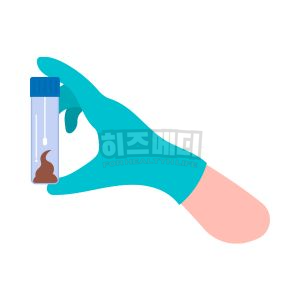 분변 잠혈검사 양성