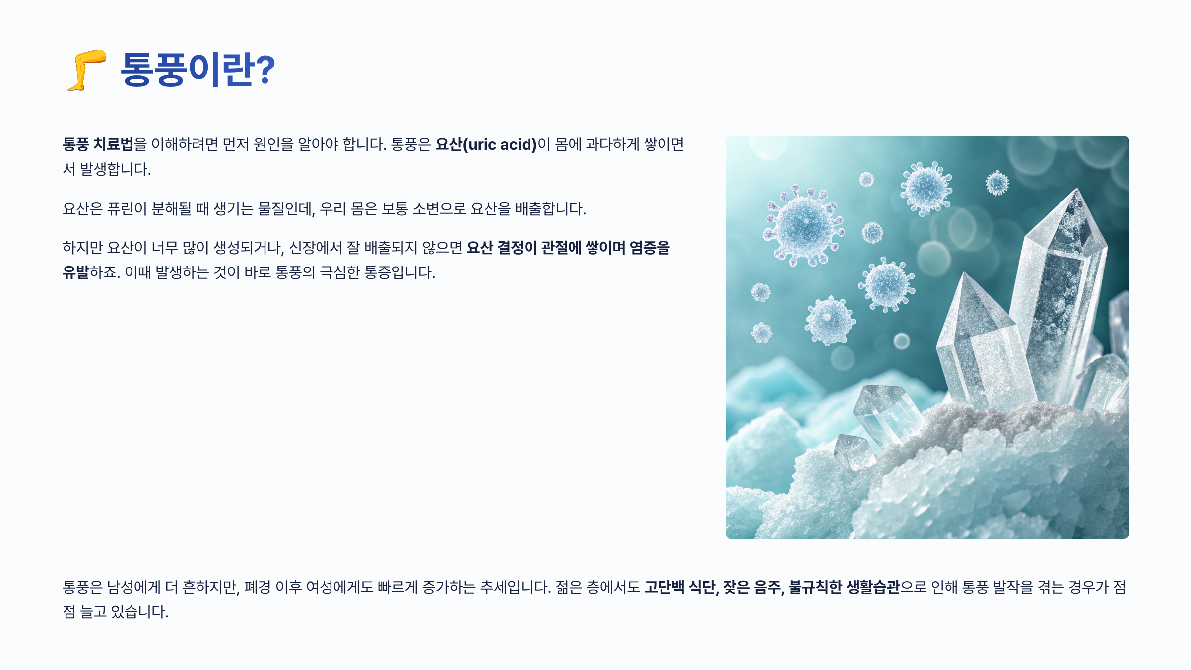 통풍 치료법 알아보기