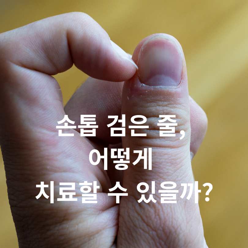 손톱에 검은 줄 증상,원인,치료법