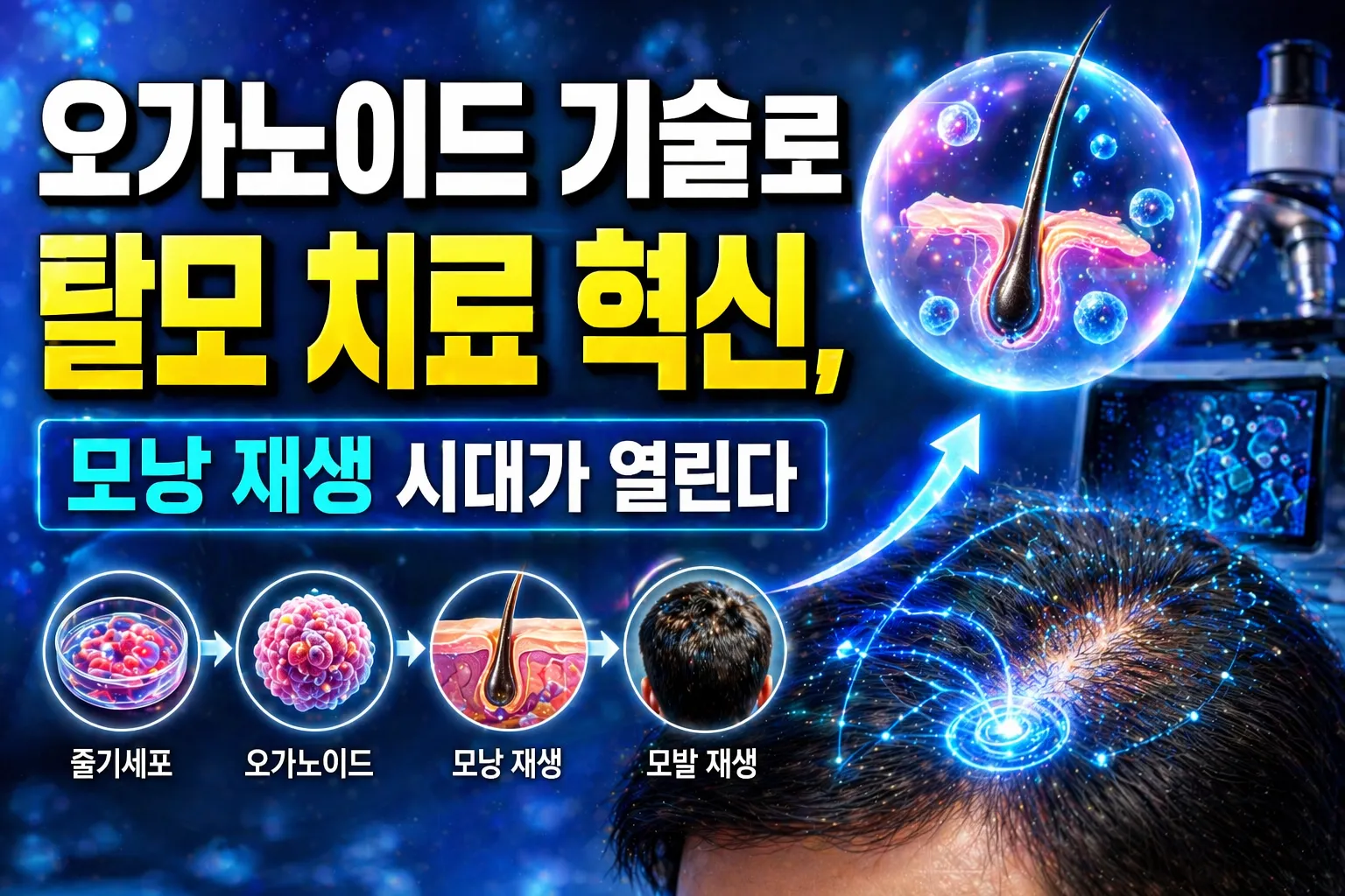 오가노이드 기술로 탈모 치료 혁신