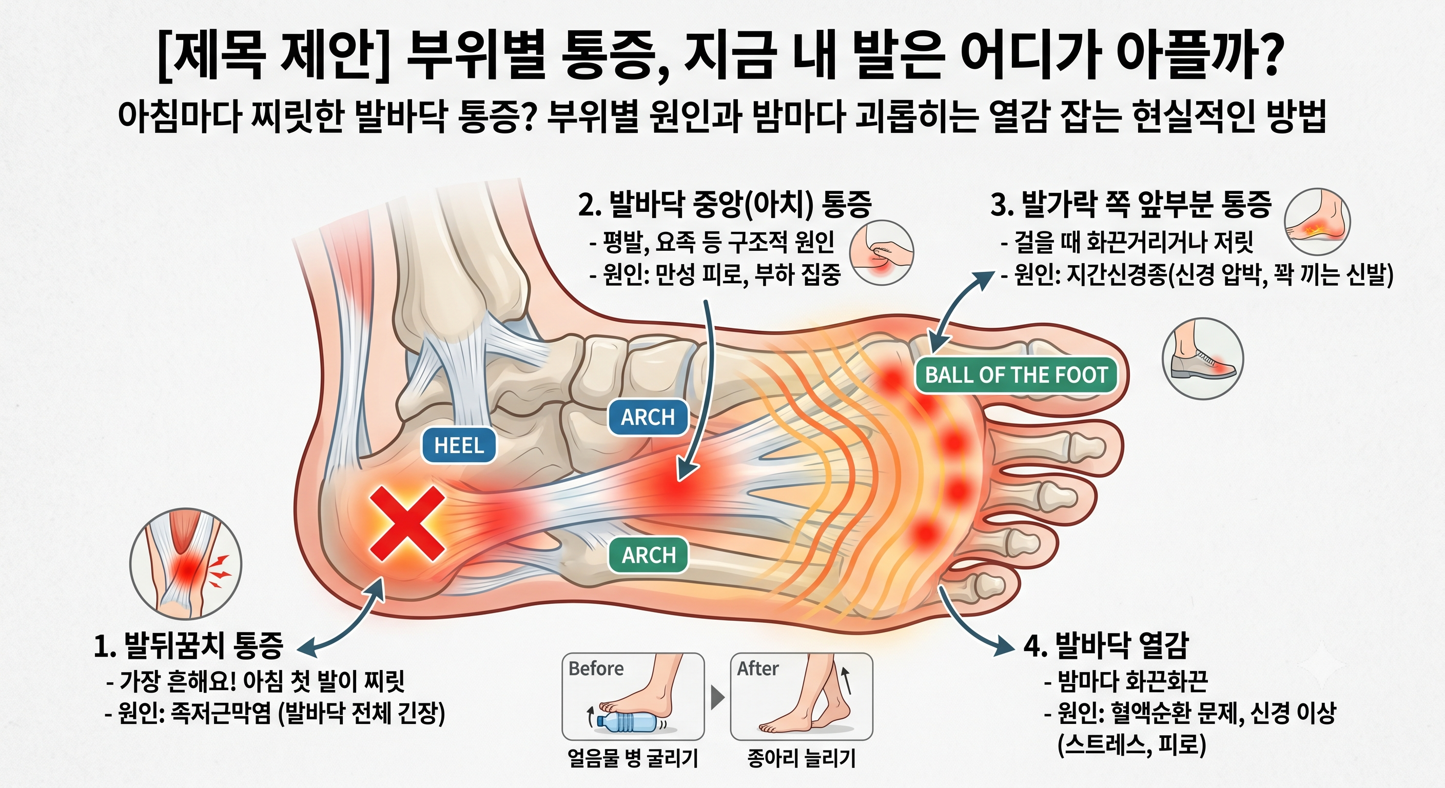 부위별 통증