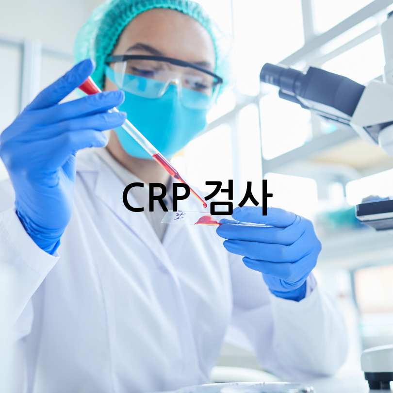 혈액검사 염증수치 검사 비용과 항목 비교