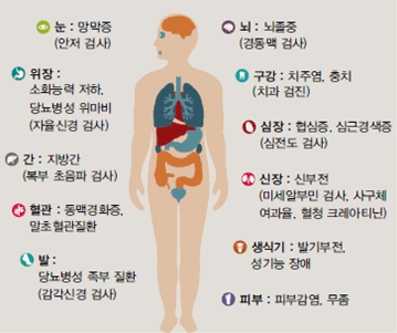 당뇨병 초기증상