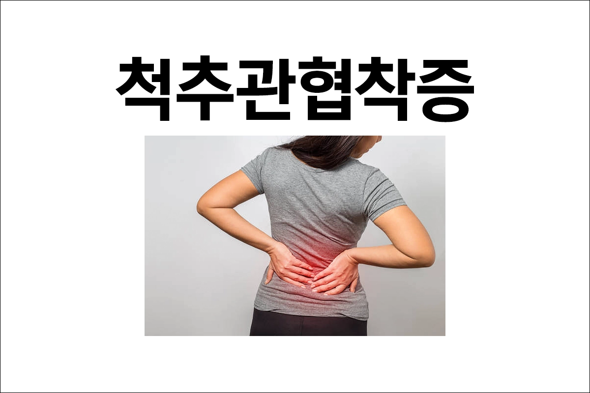 척추관협착증 원인 증상 치료 예방