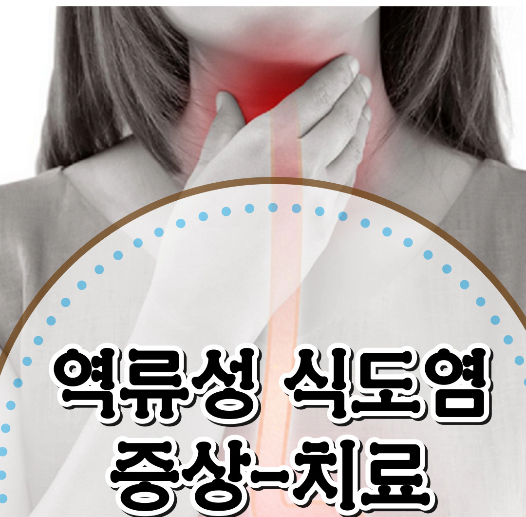 [역류성 식도염]-증상-파모티딘vs오메프라졸vs제산제vs알긴산나트륨