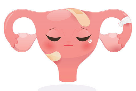 자궁경부암 검사