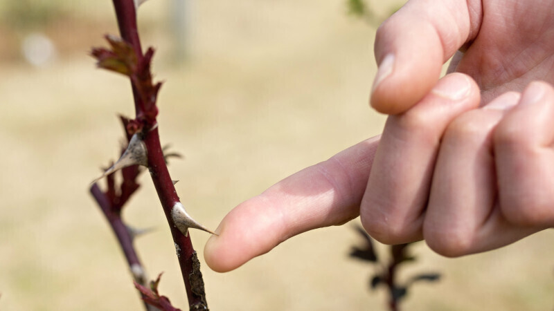 건강한 생활습관 7 : 피부에 박힌 가시 빼는 법