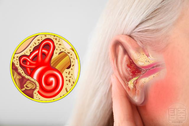 귀에서 물나옴 외이도염 증상 고름