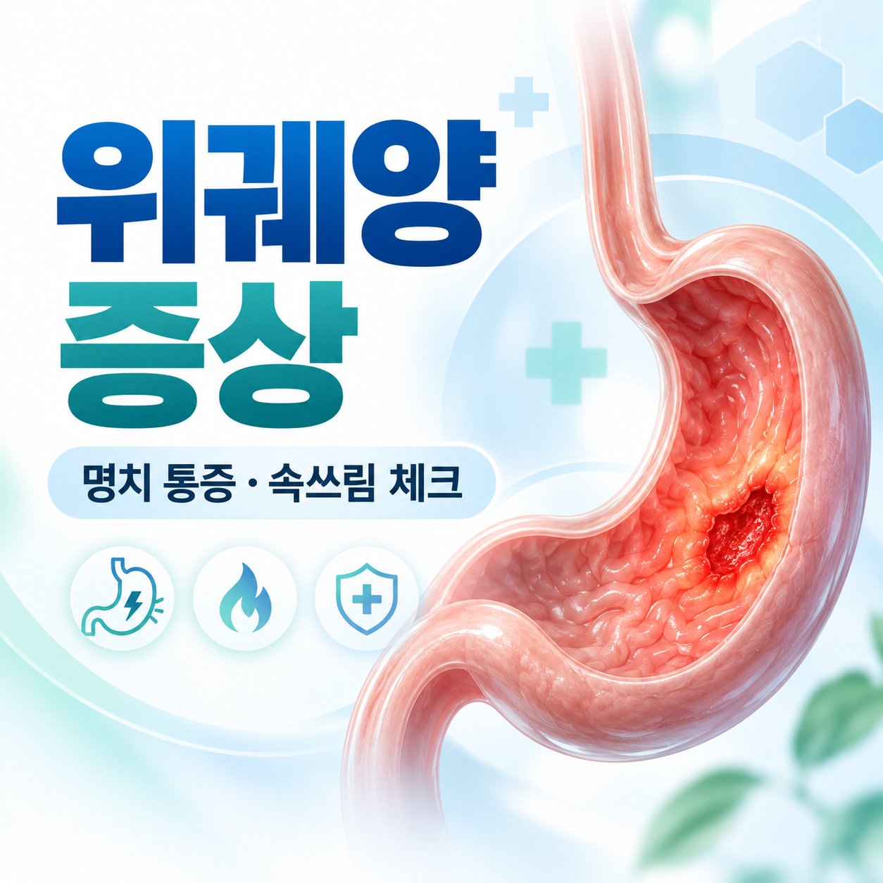 위궤양 증상