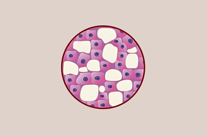 하얀-반점이-생긴-피부